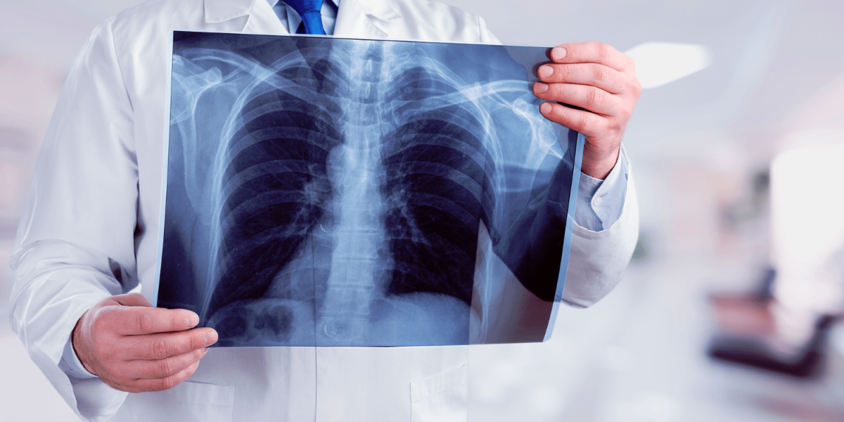 Quer saber tudo o que precisa sobre o Curso Técnico em Radiologia? Então clica no link acima e saiba mais sobre salário, grade curricular e +