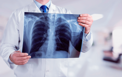 Quer saber tudo o que precisa sobre o Curso Técnico em Radiologia? Então clica no link acima e saiba mais sobre salário, grade curricular e +
